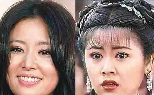 【图】林心如的牙齿整形照片对比 整完牙后事业突飞猛进