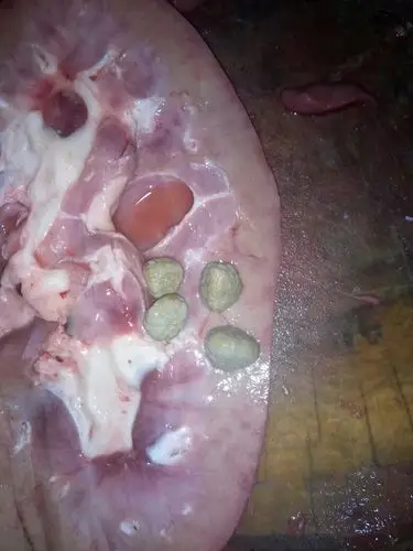 我在猪腰子里发现石头,问问有用途吗,求解答