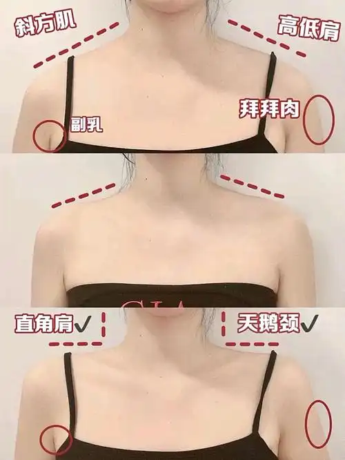 斜方肌训练!两周练出完美直角肩天鹅颈