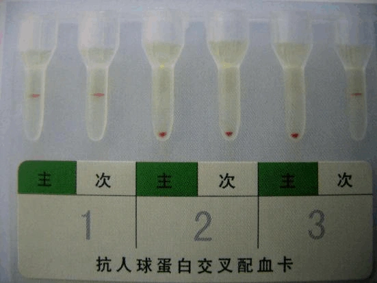 交叉配血卡 操作规程