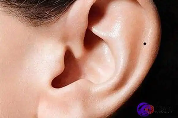 耳朵内长痣意味着什么