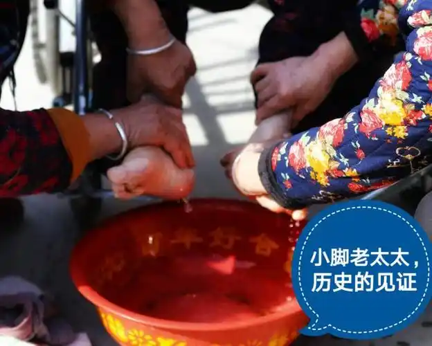 百岁老人的小脚"三寸金莲"