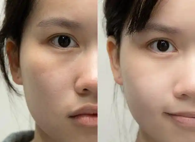 面霜|美白|细纹|精华乳|洁面乳|爽肤水|敏感肌肤_网易订阅