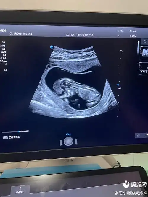 nt做了四次,不是侧睡就是趴着,还是过了,一切正正常!