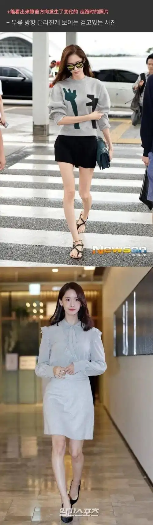 令韩网友惊奇的,少女时代允儿o型腿矫正前后!_姐姐