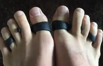 脚趾环矫正可以改变腿型吗