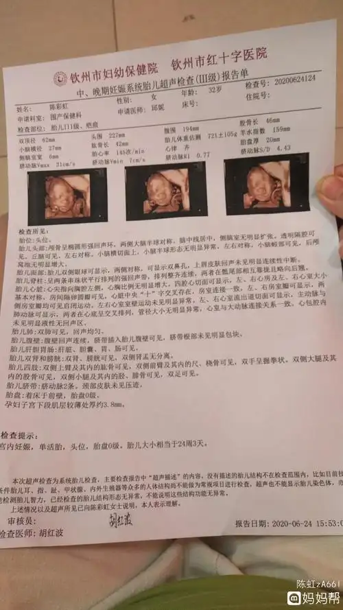 可爱!六个月四维彩超男孩图"同甘共苦"-第1张图片-萨芬博客