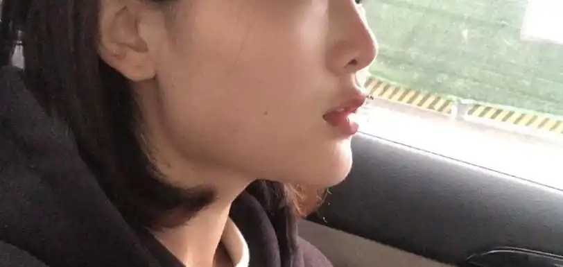 下颌角突出照片