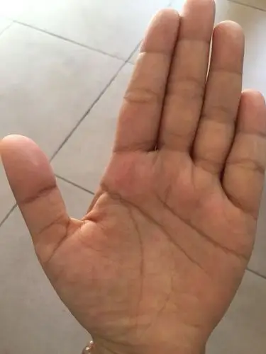 为什么左手有佛眼纹的命运这么差?