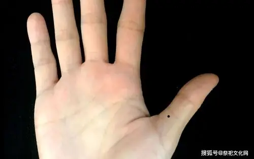 拇指通常主祖辈,如男性左手的大拇指有痣,则代表会接受到家里的祖产