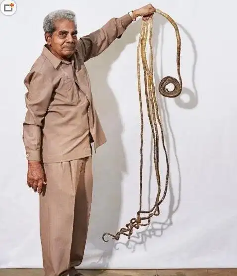 世界上指甲最长的人印度男子指甲长达9096厘米62年未剪