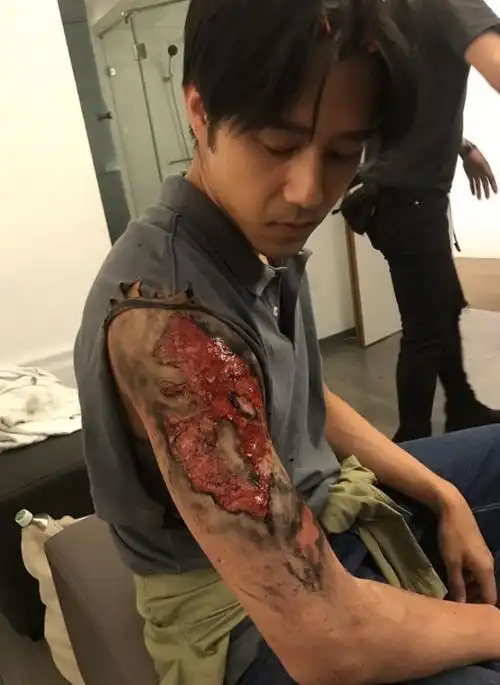 帅气男星公布伤照惹大祸老爸气到高血压