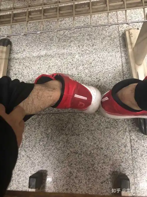 男生的腿毛应该怎么打理?