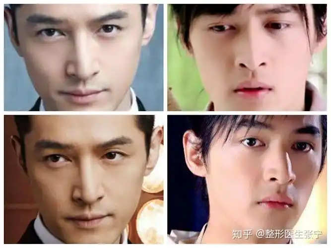 整容后的胡歌没有以前帅