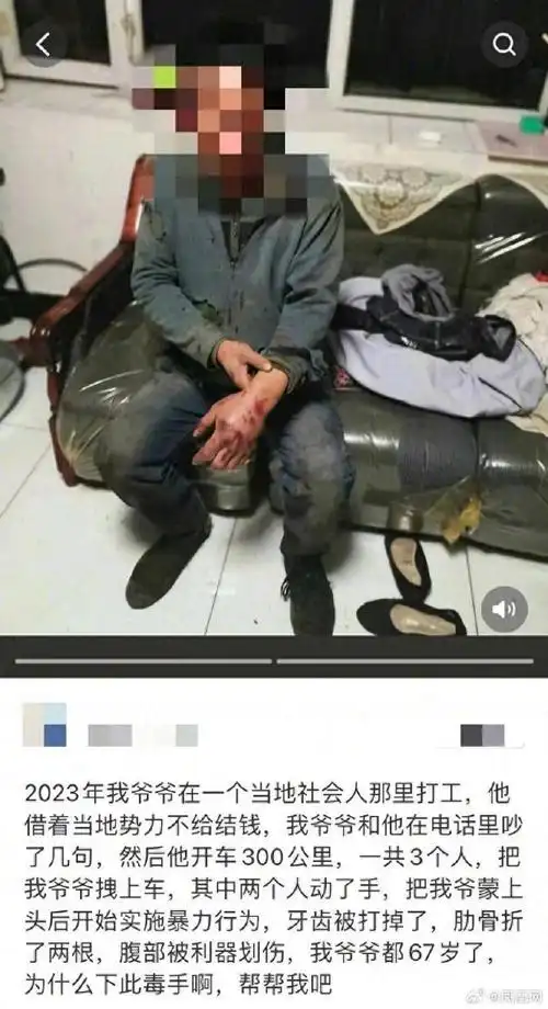 希望打人者受到应有惩罚】#警方回应67岁老人做工讨薪遭殴打#3月21日