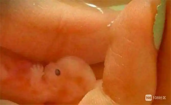 怀孕三个月打胎痛苦吗怀孕三个月可以打胎吗