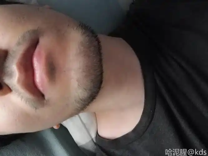 胡子稀少,有何良策