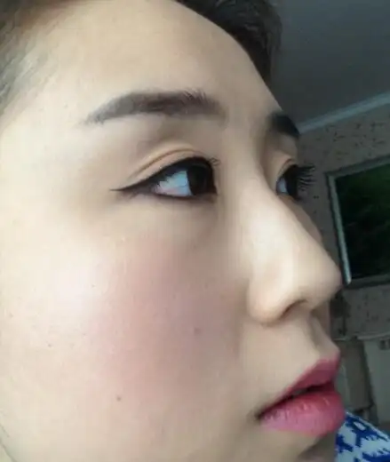 如何化解山根有横纹所带来的算命运势?