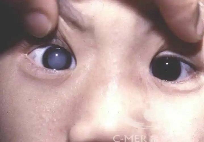 电子产品凶猛! 现代孩子应该如何保护眼睛