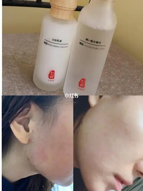 化妆品_护肤_菊花_水乳_洋甘菊_角鲨烷_抗衰老_舒缓抗敏_改善皮肤