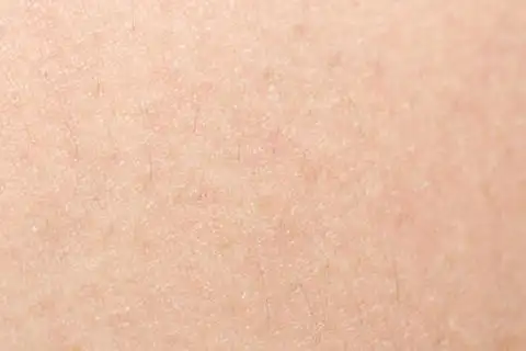 软焦点人体皮肤纹理与健康组织的黑色的头发