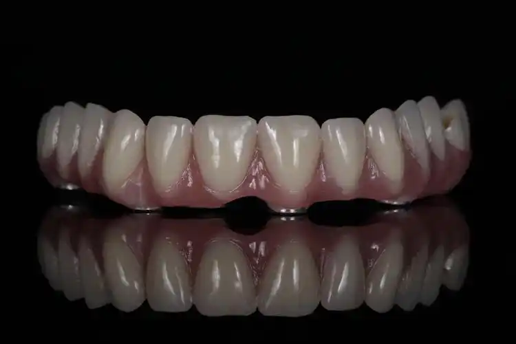 cadcam纯钛切削桥架树脂排牙修复