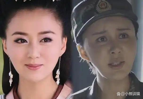 4位科技脸反面教材初见荧屏惊鸿一瞥再见整容颜垮不敢认