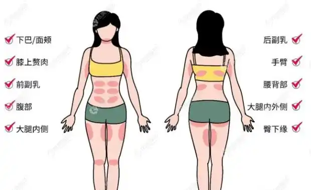 如果是大部位的吸脂可以超脂塑www.17qzx.com