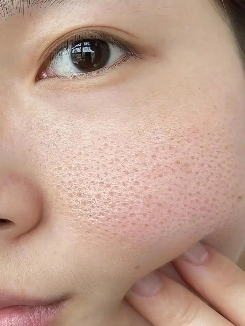 毛孔粗大的姐妹,请狂刷到我!惊雷事件!竟然体会到了毛孔细腻 - 抖音