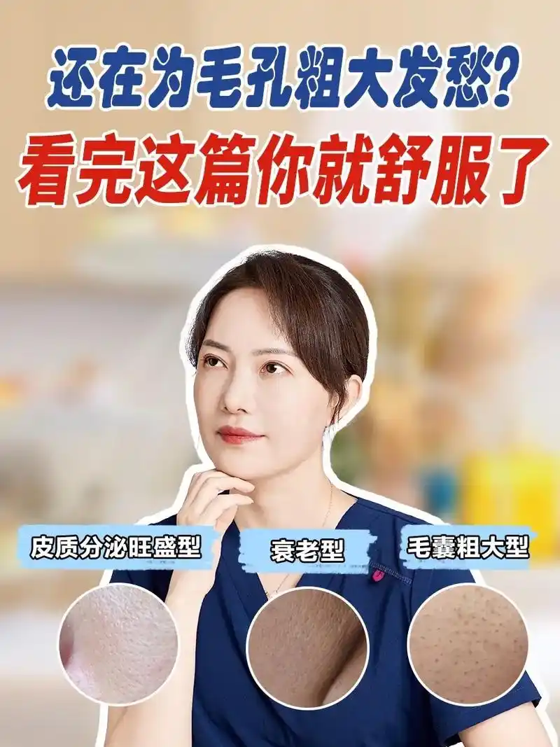 毛孔粗大怎么办71这些办法可能对你有帮助60①皮脂分泌旺盛型 形