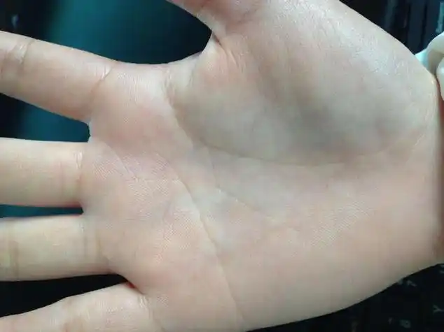 好命女人7个手相暗示大富大贵,好命女人手相:手背上长痣女人的手背上