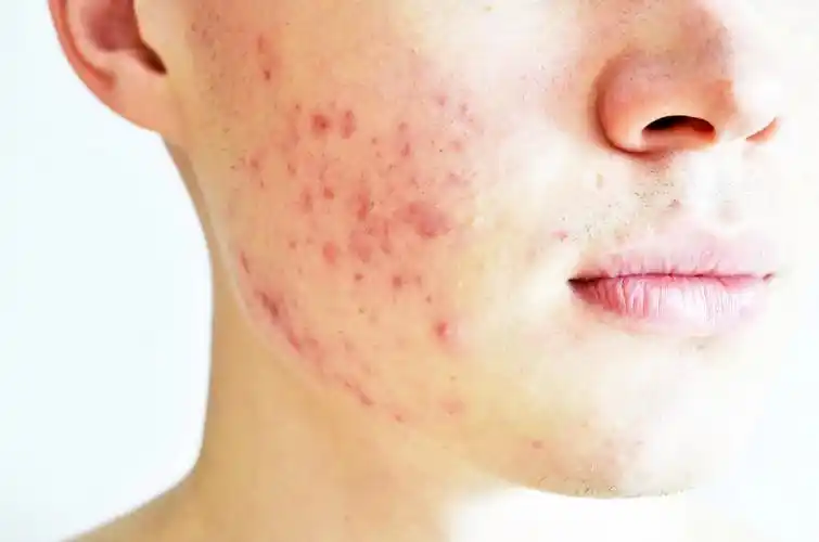 皮肤有问题的人