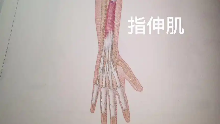 指伸肌(手指,腕部疼痛,肘痛,手指僵硬,手指乏力等)