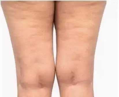 二字顶流美少女暴瘦20斤竟被爆去韩国吸脂