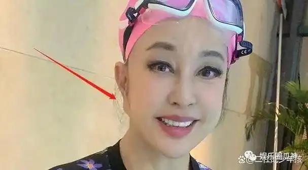 70岁刘晓庆素颜照因拉皮导致长成如来佛祖一样的大长耳朵