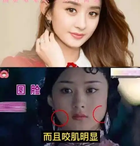 知情人曝赵丽颖整容细节