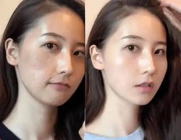 口碑最好的祛斑霜是哪款?看懂这篇就知道了