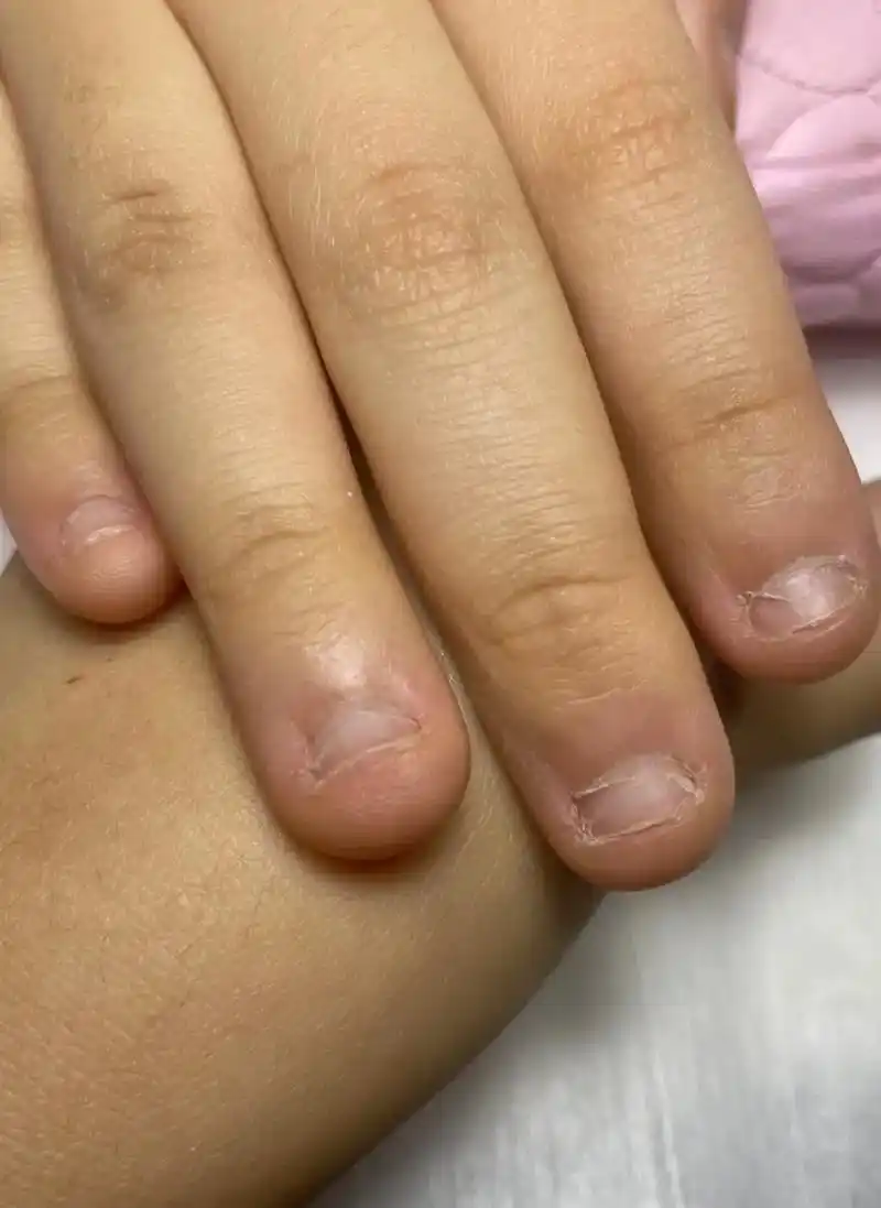 短指甲也可以这么美 #啃指甲矫 - 抖音