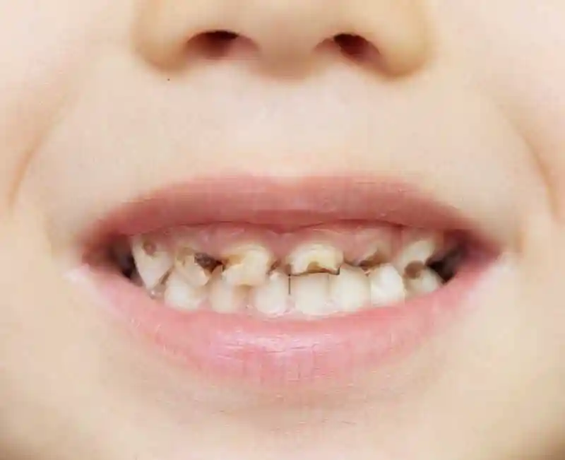 不齐的牙齿图片-一口黄牙素材-高清图片-摄影照片-寻图免费打包下载