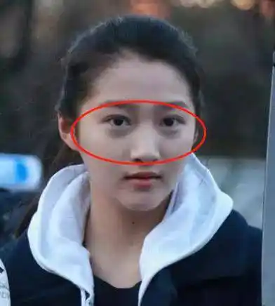 关晓彤这种卧蚕,眼袋傻傻分不清楚,如果不好好保护眼睛,小可爱都能秒