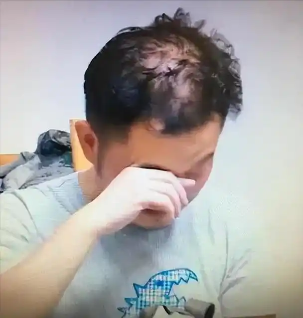 这6位男神中年秃顶,从郑少秋到黄晓明,个个发际线高到离谱!