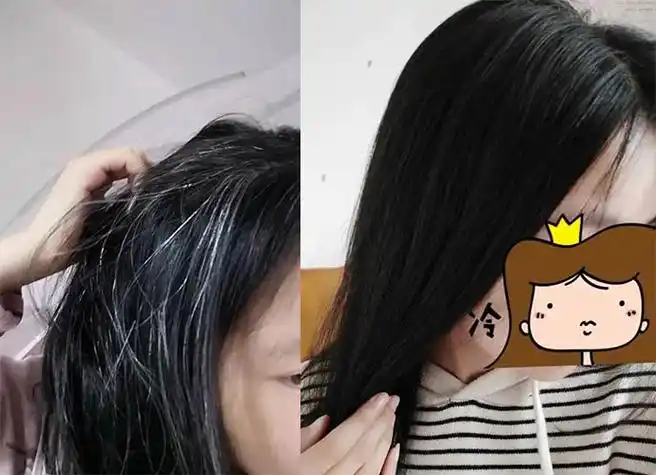 五年白发变黑发亲身经历看完让你摆脱白发的困扰