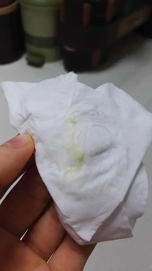 怀孕白带症状 大家有一样的嘛