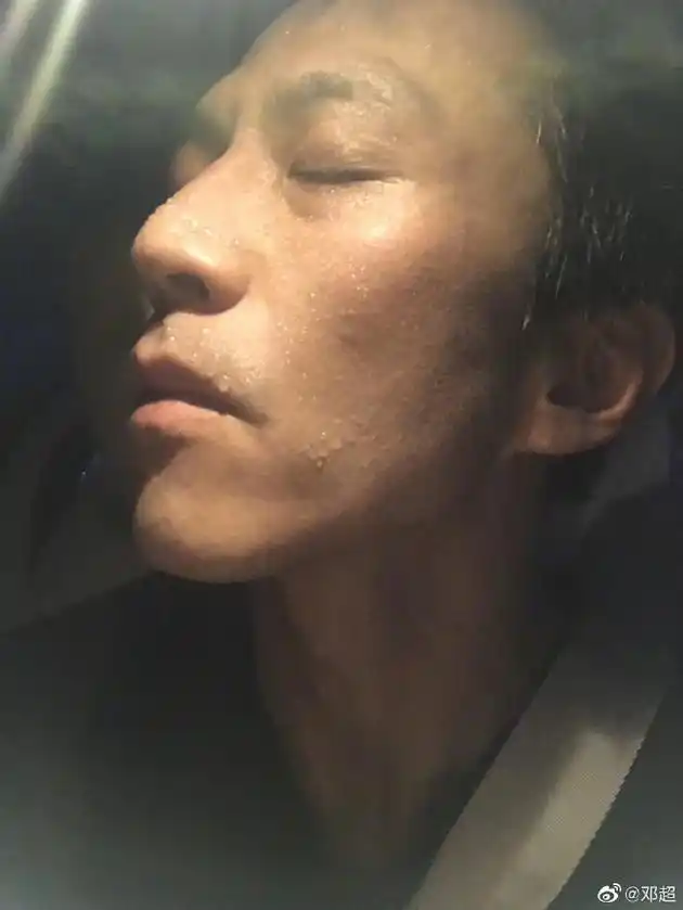 邓超晒侧颜照脸颊消瘦欲为新戏增重求问如何变胖