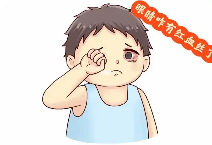 1分钟让你了解眼睛红血丝