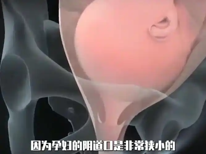 人在生孩子时能有多难受?产妇分娩全过程实录!一边用力一边哭喊