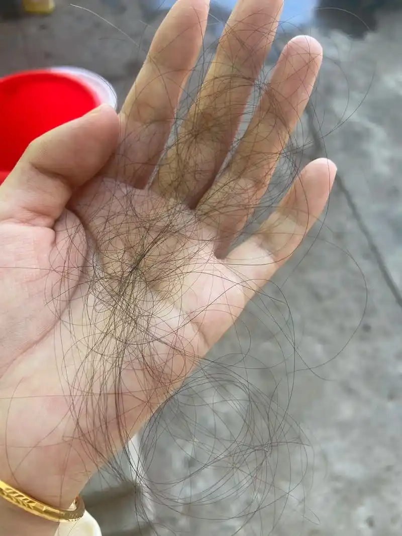 产后脱发.顺产四个月,我以为我不会掉头发,最终还是没逃过,越 - 抖音