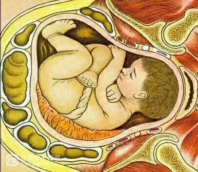 31周胎儿横位,还能顺产吗?