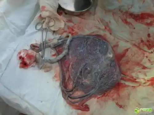 谁见过胎盘的,有图片吗,发来看看 (有图片) .