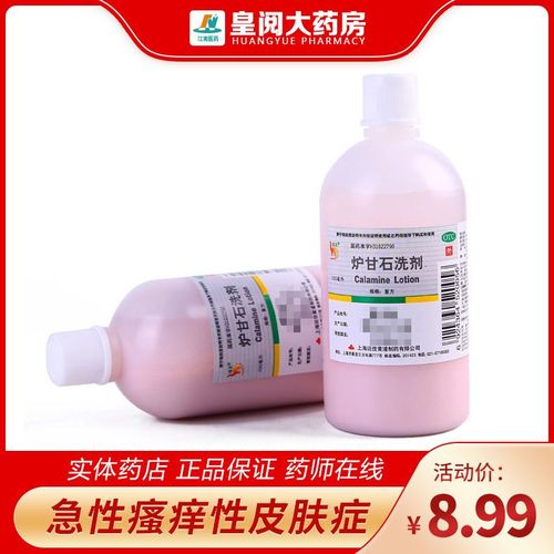 信龙炉甘石洗剂100ml皮炎湿疹洗液 止痒皮肤病痱子洗涤剂瘙痒鹏鹞